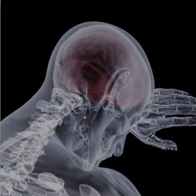 Brain Injury Personal Injury Attorney