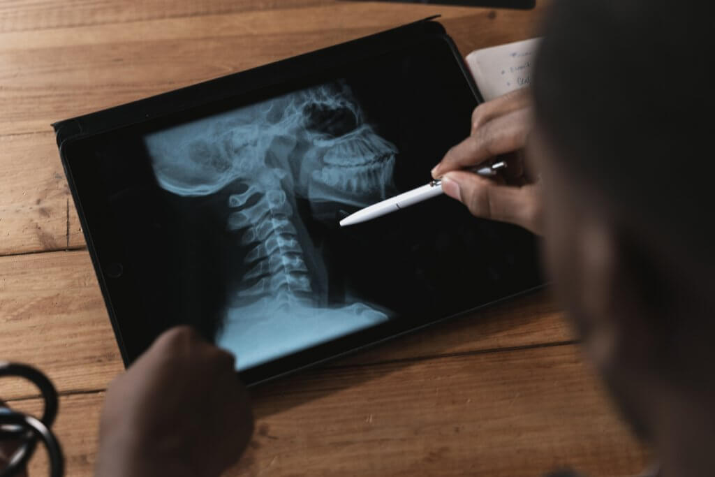 doctor examining x-ray